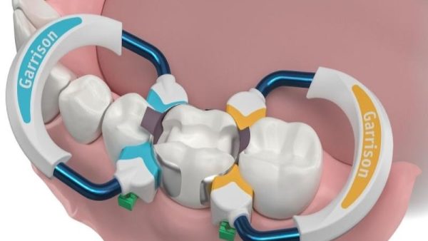 Innovations in Sectional Matrix Systems and More